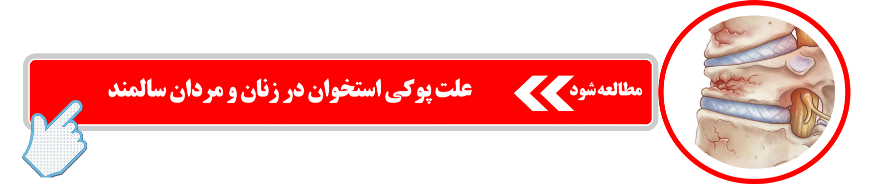 علت پوکی استخوان در زنان و مردان سالمند