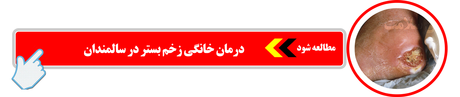 درمان خانگی زخم بستر در خانه